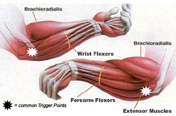 forearm muscles - Boulder Therapeutics